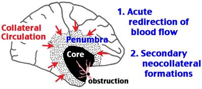 Impaired post-stroke collateral circulation in sickle cell anemia mice